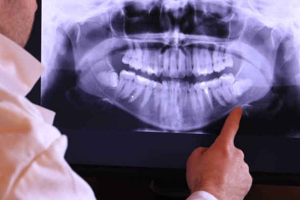 Best Teeth Whitening  in Corsicana, TX