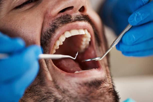 Best Broken Tooth Emergency  in Corsicana, TX