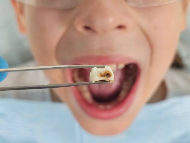 Best Tooth Pain Emergency Relief  in Corsicana, TX