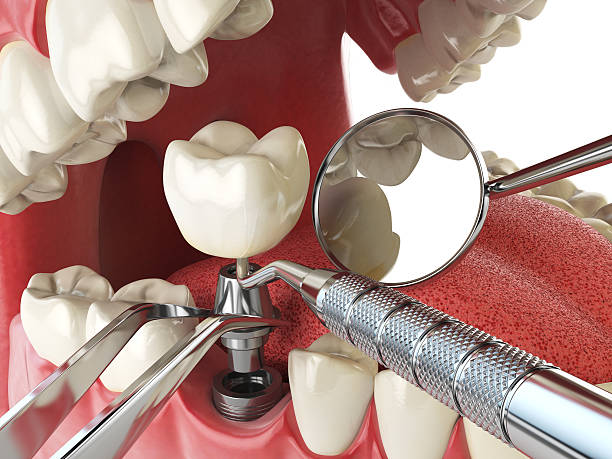 Best Emergency Gum Pain Relief  in Corsicana, TX
